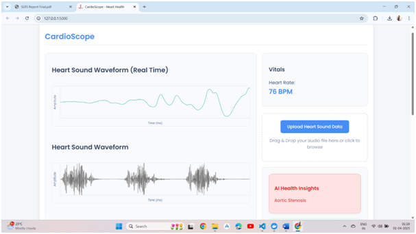 CardioScope AI Stethoscope